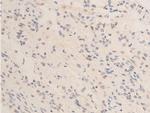 Phospho-Chk2 (Thr68) Antibody in Immunohistochemistry (Paraffin) (IHC (P))