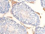 Phospho-Chk2 (Thr68) Antibody in Immunohistochemistry (Paraffin) (IHC (P))