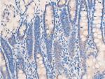 Phospho-Chk2 (Thr68) Antibody in Immunohistochemistry (Paraffin) (IHC (P))