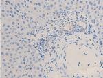 Phospho-Chk2 (Thr68) Antibody in Immunohistochemistry (Paraffin) (IHC (P))