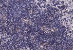 Phospho-EGFR (Ser1070) Antibody in Immunohistochemistry (Paraffin) (IHC (P))