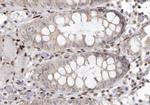 Phospho-EGFR (Tyr1092) Antibody in Immunohistochemistry (Paraffin) (IHC (P))