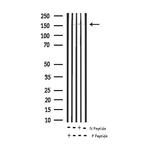 Phospho-EGFR (Tyr1092) Antibody in Western Blot (WB)