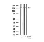 Phospho-EGFR (Tyr1110) Antibody in Western Blot (WB)