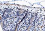 Phospho-EGFR (Tyr1197) Antibody in Immunohistochemistry (Paraffin) (IHC (P))