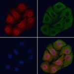 Phospho-EGFR (Ser1026) Antibody in Immunocytochemistry (ICC/IF)