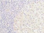 Phospho-EGFR (Ser1026) Antibody in Immunohistochemistry (Paraffin) (IHC (P))