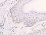 Phospho-EGFR (Ser1026) Antibody in Immunohistochemistry (Paraffin) (IHC (P))