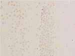 Phospho-EGFR (Ser1026) Antibody in Immunohistochemistry (Paraffin) (IHC (P))