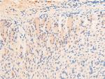 Phospho-EGFR (Ser1026) Antibody in Immunohistochemistry (Paraffin) (IHC (P))