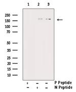 Phospho-EGFR (Ser1026) Antibody in Western Blot (WB)