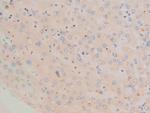 Phospho-c-Fos (Ser362) Antibody in Immunohistochemistry (Paraffin) (IHC (P))