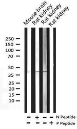 Phospho-c-Fos (Ser362) Antibody in Western Blot (WB)