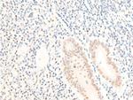 Phospho-c-Myc (Ser62) Antibody in Immunohistochemistry (Paraffin) (IHC (P))