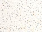 Phospho-c-Myc (Ser62) Antibody in Immunohistochemistry (Paraffin) (IHC (P))