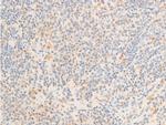 Phospho-c-Myc (Ser62) Antibody in Immunohistochemistry (Paraffin) (IHC (P))