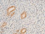 Phospho-c-Myc (Ser62) Antibody in Immunohistochemistry (Paraffin) (IHC (P))