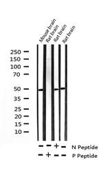 Phospho-c-Myc (Ser62) Antibody in Western Blot (WB)