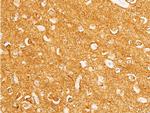 Phospho-c-Myc (Thr58) Antibody in Immunohistochemistry (Paraffin) (IHC (P))