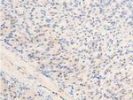 Phospho-c-Myc (Thr58) Antibody in Immunohistochemistry (Paraffin) (IHC (P))