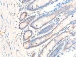 Phospho-c-Myc (Thr58) Antibody in Immunohistochemistry (Paraffin) (IHC (P))