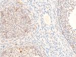 Phospho-c-Myc (Thr58) Antibody in Immunohistochemistry (Paraffin) (IHC (P))