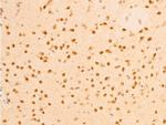 Phospho-Lamin A/C (Ser392) Antibody in Immunohistochemistry (Paraffin) (IHC (P))