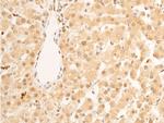 Phospho-Lamin A/C (Ser392) Antibody in Immunohistochemistry (Paraffin) (IHC (P))