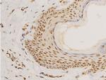 Phospho-Lamin A/C (Ser392) Antibody in Immunohistochemistry (Paraffin) (IHC (P))