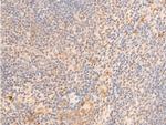 Phospho-Lamin A/C (Ser392) Antibody in Immunohistochemistry (Paraffin) (IHC (P))