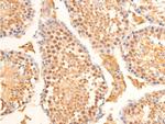 Phospho-Lamin A/C (Ser392) Antibody in Immunohistochemistry (Paraffin) (IHC (P))