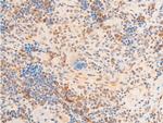 Phospho-Lamin A/C (Ser392) Antibody in Immunohistochemistry (Paraffin) (IHC (P))