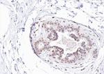 Phospho-Estrogen Receptor alpha (Tyr537) Antibody in Immunohistochemistry (Paraffin) (IHC (P))