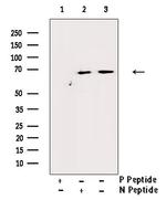 Phospho-Estrogen Receptor alpha (Tyr537) Antibody in Western Blot (WB)