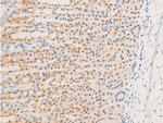 Phospho-Glucocorticoid Receptor (Ser226) Antibody in Immunohistochemistry (Paraffin) (IHC (P))