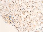 Phospho-Glucocorticoid Receptor (Ser226) Antibody in Immunohistochemistry (Paraffin) (IHC (P))