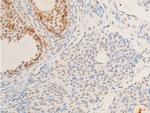 Phospho-Glucocorticoid Receptor (Ser226) Antibody in Immunohistochemistry (Paraffin) (IHC (P))