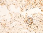 Phospho-TK1 (Ser13) Antibody in Immunohistochemistry (Paraffin) (IHC (P))