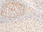 Phospho-TK1 (Ser13) Antibody in Immunohistochemistry (Paraffin) (IHC (P))