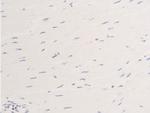 Phospho-ErbB2 (HER-2) (Tyr877) Antibody in Immunohistochemistry (Paraffin) (IHC (P))