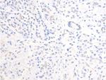 Phospho-ErbB2 (HER-2) (Tyr877) Antibody in Immunohistochemistry (Paraffin) (IHC (P))