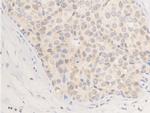 Phospho-ErbB2 (HER-2) (Tyr877) Antibody in Immunohistochemistry (Paraffin) (IHC (P))