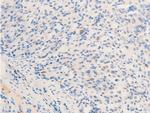 Phospho-ErbB2 (HER-2) (Tyr877) Antibody in Immunohistochemistry (Paraffin) (IHC (P))