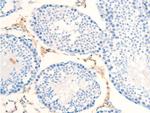 Phospho-ErbB2 (HER-2) (Tyr877) Antibody in Immunohistochemistry (Paraffin) (IHC (P))