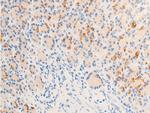 Phospho-ErbB2 (HER-2) (Tyr877) Antibody in Immunohistochemistry (Paraffin) (IHC (P))