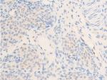 Phospho-ErbB2 (HER-2) (Tyr877) Antibody in Immunohistochemistry (Paraffin) (IHC (P))