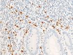 Phospho-ErbB2 (HER-2) (Tyr1112) Antibody in Immunohistochemistry (Paraffin) (IHC (P))