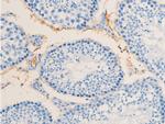 Phospho-ErbB2 (HER-2) (Tyr1112) Antibody in Immunohistochemistry (Paraffin) (IHC (P))