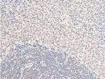 Phospho-ErbB2 (HER-2) (Tyr1112) Antibody in Immunohistochemistry (Paraffin) (IHC (P))