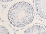 Phospho-ErbB2 (HER-2) (Tyr1112) Antibody in Immunohistochemistry (Paraffin) (IHC (P))